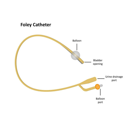 PTFE Aquaflate Urinary Male Balloon Catheter, Latex from Aquaflate.